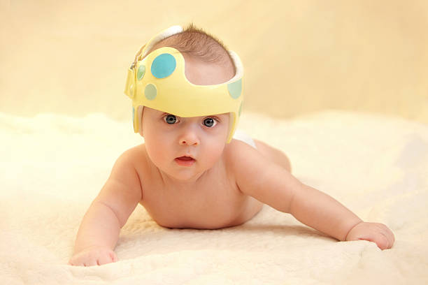 istock Cranial Orthodic for Plagiocephaly 182471395