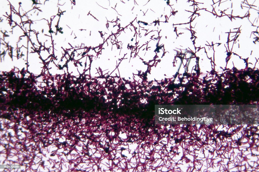 Candida Albicans Levure - Photo de Candidose buccale - Infection fongique libre de droits