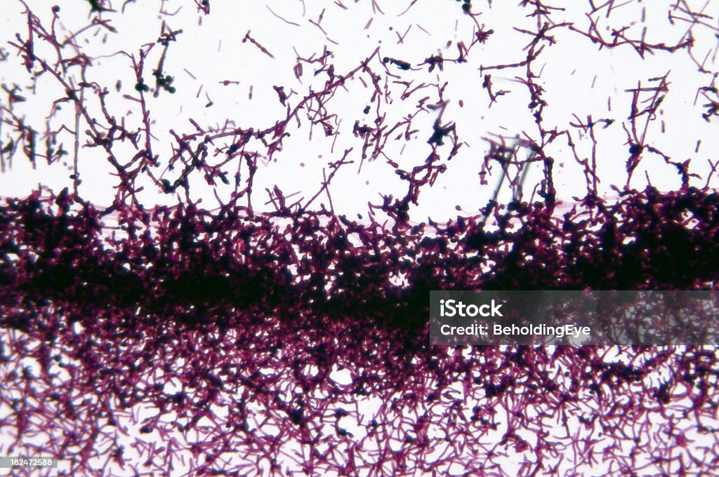 Грибы рода Candida Albicans дрожжи - Стоковые фото Молочница - инфекция роялти-фри