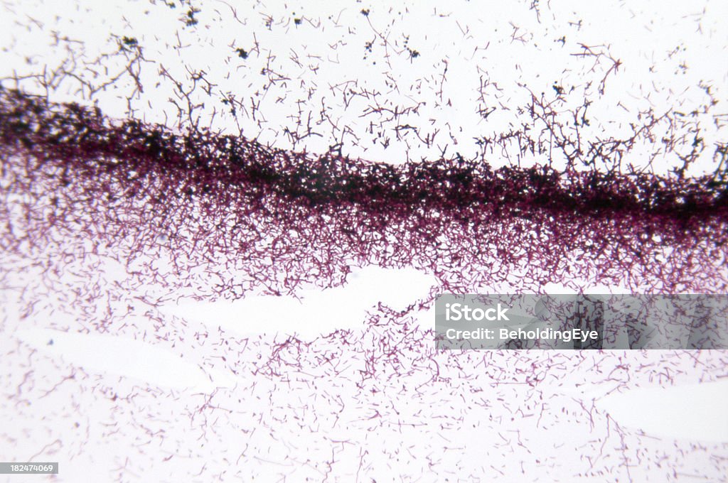 Candida Albicans Fermento - Foto de stock de Candidíase royalty-free