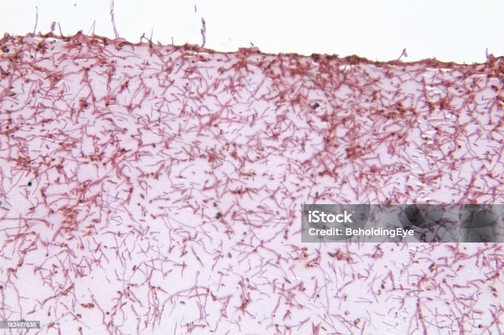 Microsporum Gypseum 菌 - クローズアップのロイヤリティフリーストックフォト
