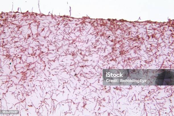 Microsporum Gypseum 菌 - クローズアップのストックフォトや画像を多数ご用意 - クローズアップ, シミ汚れ, ヘルスケアと医療