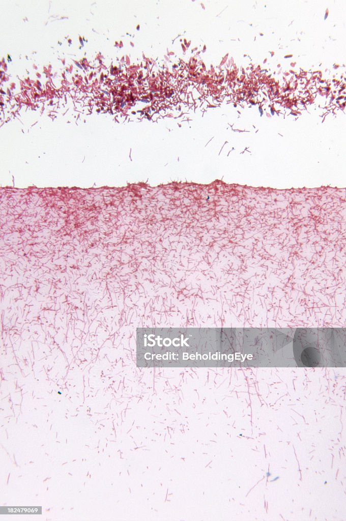 Microsporum Gypseum Fungo - Foto stock royalty-free di Astratto