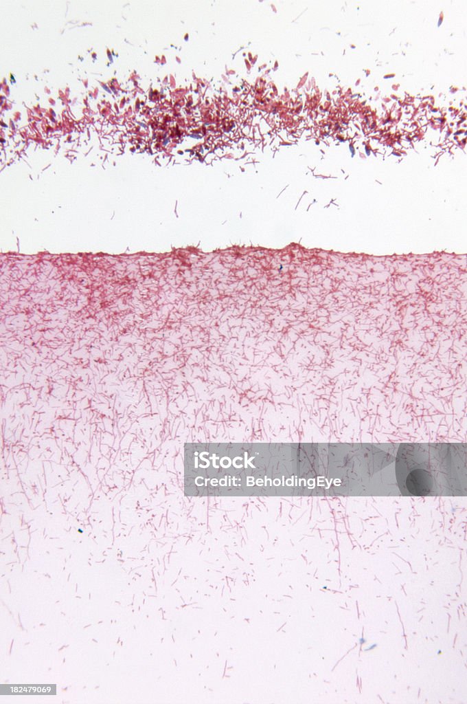 Microsporum Gypseum Fungo - Foto de stock de Abstrato royalty-free