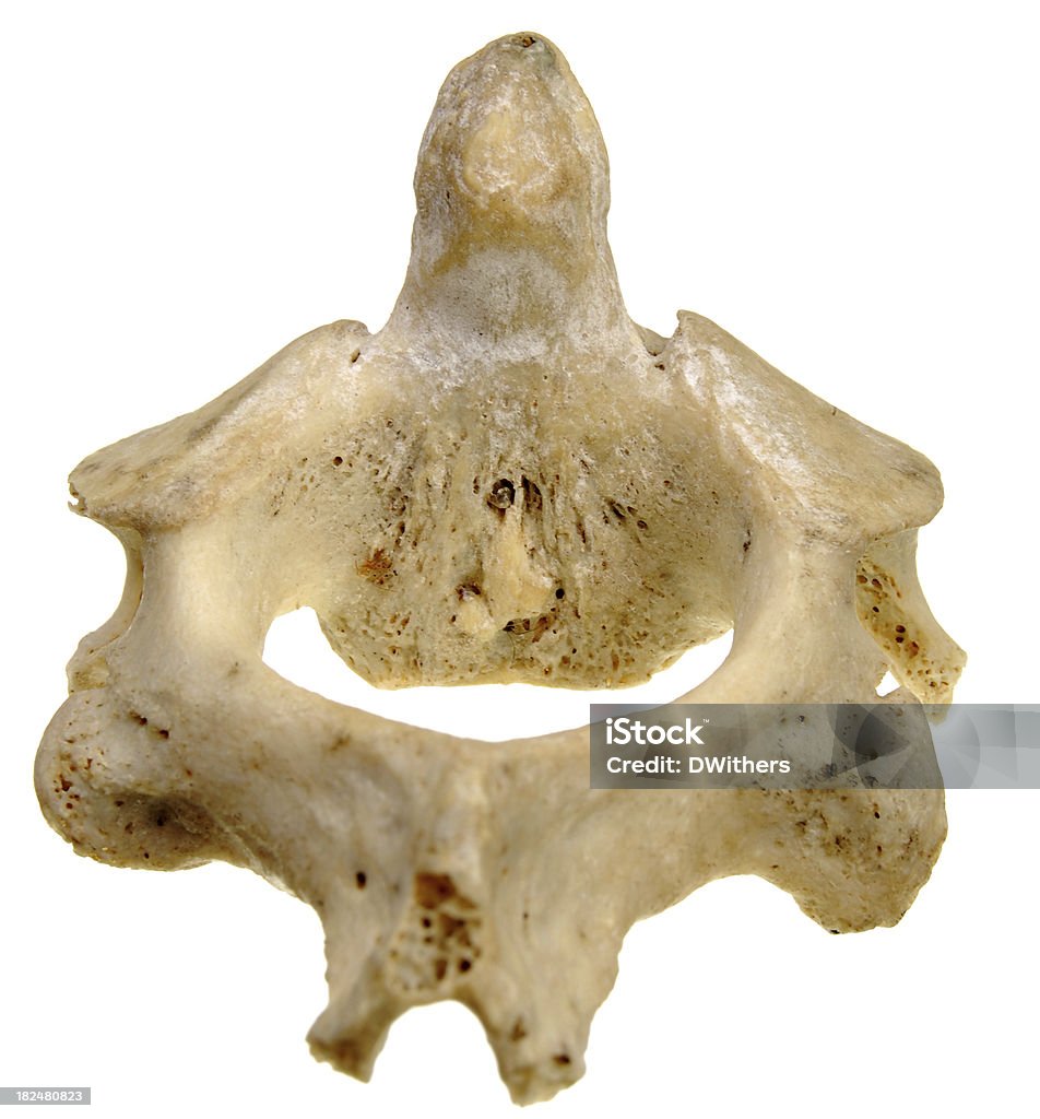 Vértebra humana segundo Cervical-VISTA ESPECTACULAR - Foto de stock de Anatomía libre de derechos