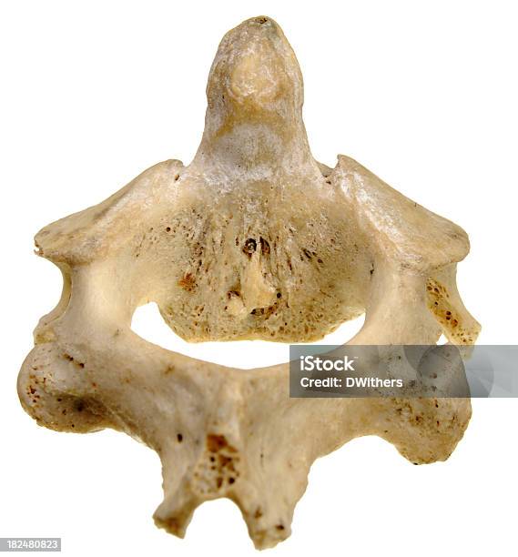 Vértebra Humana Segundo Cervicalvista Espectacular Foto de stock y más banco de imágenes de Anatomía