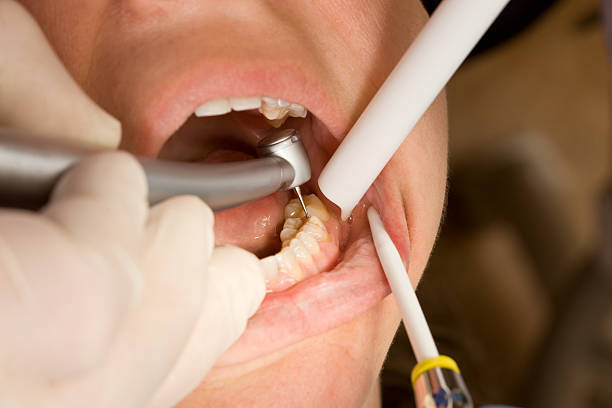 Dentistry airflow tool in the hand on dentist office