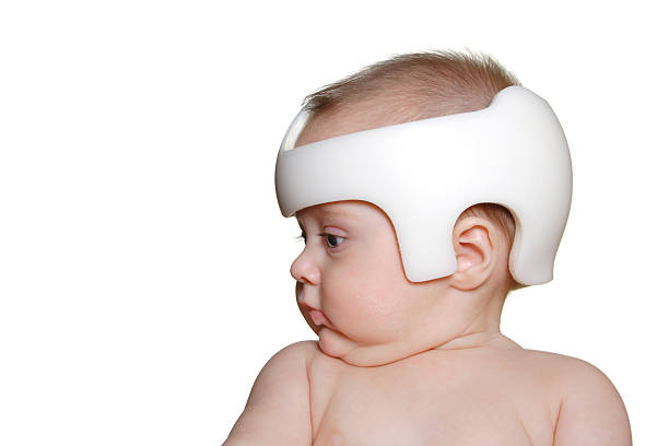 Side View of Plagiocephaly Band Infant wearing a helmet or band for treatment of plagiocephaly. Isolated on white.SEE ALSO: plagiocephaly stock pictures, royalty-free photos & images