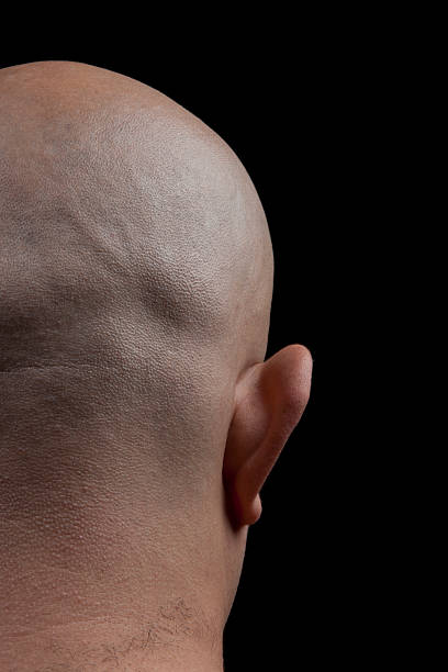 istock back view of a bald man's shaved head 182490968