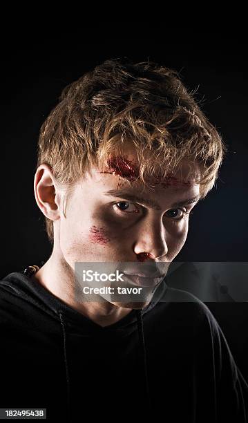 Young Injured Man Stock Photo - Download Image Now - Adult, Adults