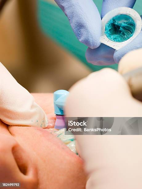 Dentista Limpar E Polir Dentes Com Um Marcador De Ferramenta De Dentista - Fotografias de stock e mais imagens de Adulto