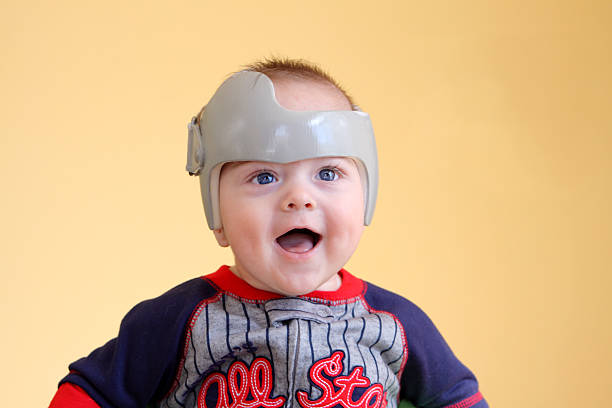 Plagiocephaly Treatment Infant wearing a helmet or band for treatment of plagiocephaly SEE ALSO: plagiocephaly stock pictures, royalty-free photos & images