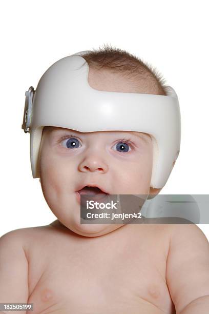 Photo libre de droit de Enfant Portant Groupe Pour Plagiocephaly banque d'images et plus d'images libres de droit de Casque - Casque, Casque de sécurité, Santé et médecine