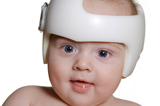 Child wearing band for Plagiocephaly Infant wearing a helmet or band for treatment of plagiocephaly. Isolated on white. SEE ALSO: plagiocephaly stock pictures, royalty-free photos & images