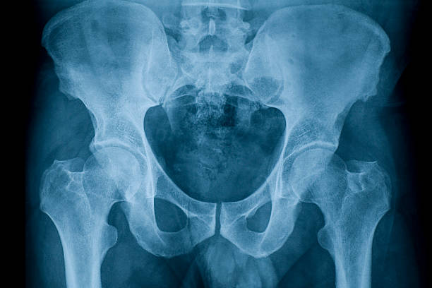 pelvis X-ray image of pelvis hip body part stock pictures, royalty-free photos & images