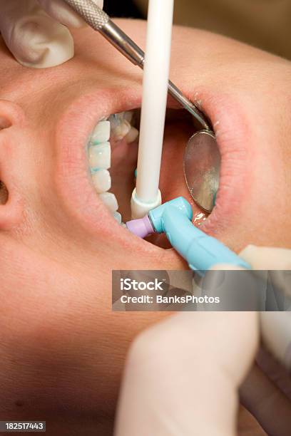 Dentist Cleaning And Polishing Teeth With A Rotary Dental Tool Stock Photo - Download Image Now