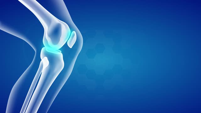 Joint Inflammation and Treatment of Inflamed Knee with Arthritis. Anti-inflammatory Medication of Bone Pain. Illustrative Medical Animation of Osteoarthritis Therapy.