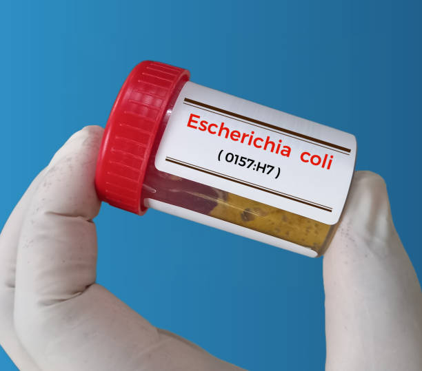 stuhlprobe für escherichia coli (e. coli) o157:h7-test. serotyp von escherichia coli-bakterien. - serotype stock-fotos und bilder