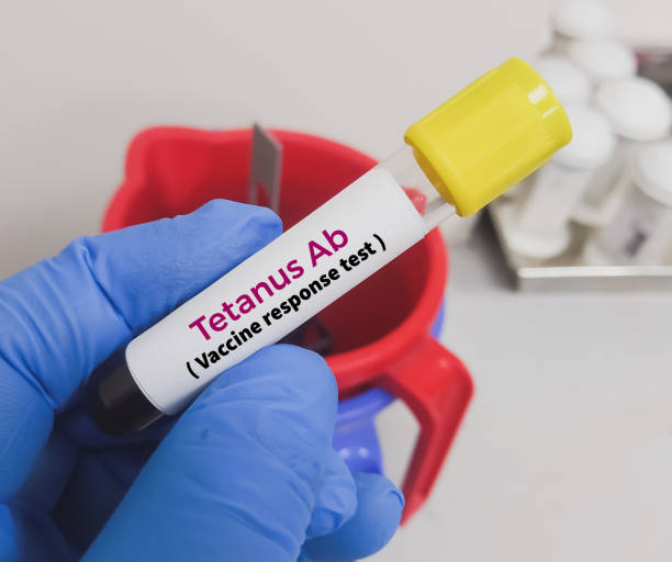 istock Tetanus Antibody test. vaccine response measurement test. 1826255208