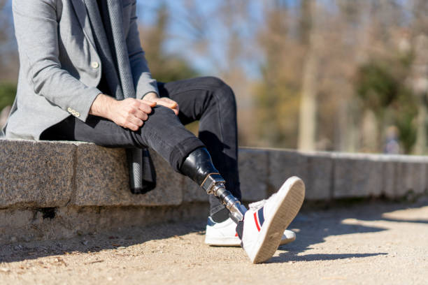 istock Young man missing a leg putting on a prosthetic leg 1826771176