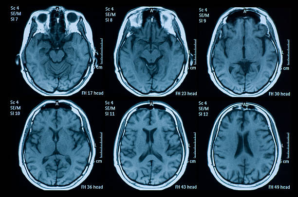 brain - medische scan stockfoto's en -beelden