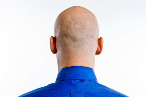 Man stands with back of his bald shaved head towards the camera