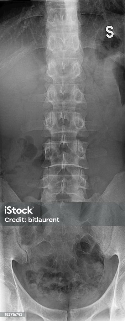 Radiografia spina dorsale - Стоковые фото Вертикальный роялти-фри