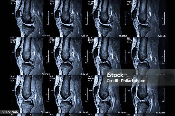 Mri スキャン人間の膝 - MRI検査のストックフォトや画像を多数ご用意 - MRI検査, X線撮影, カラー画像