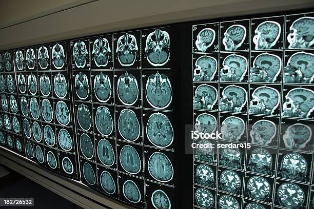 Brain Scan Stock Photo - Download Image Now - Anatomy, Brain, CAT Scan