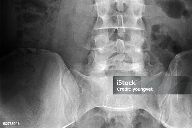 Radiografia Della Colonna Vertebrale Lombare Sacro E Iliosacral Comune - Fotografie stock e altre immagini di Adulto