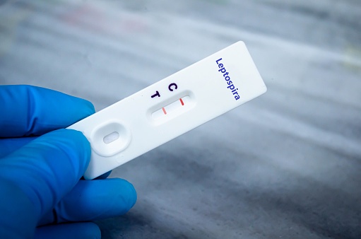 Blood sample of patient positive tested for leptospirosis by rapid diagnostic test.