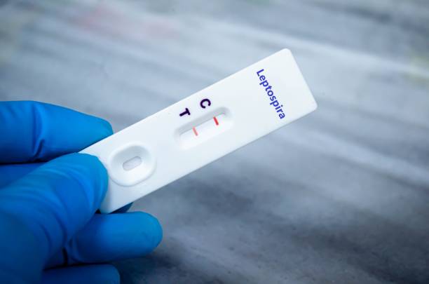 RDT Blood sample of patient positive tested for leptospirosis by rapid diagnostic test. leptospira stock pictures, royalty-free photos & images
