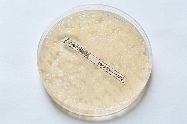 антибиотик тестирование: esbl - esbl стоковые фото и изображения