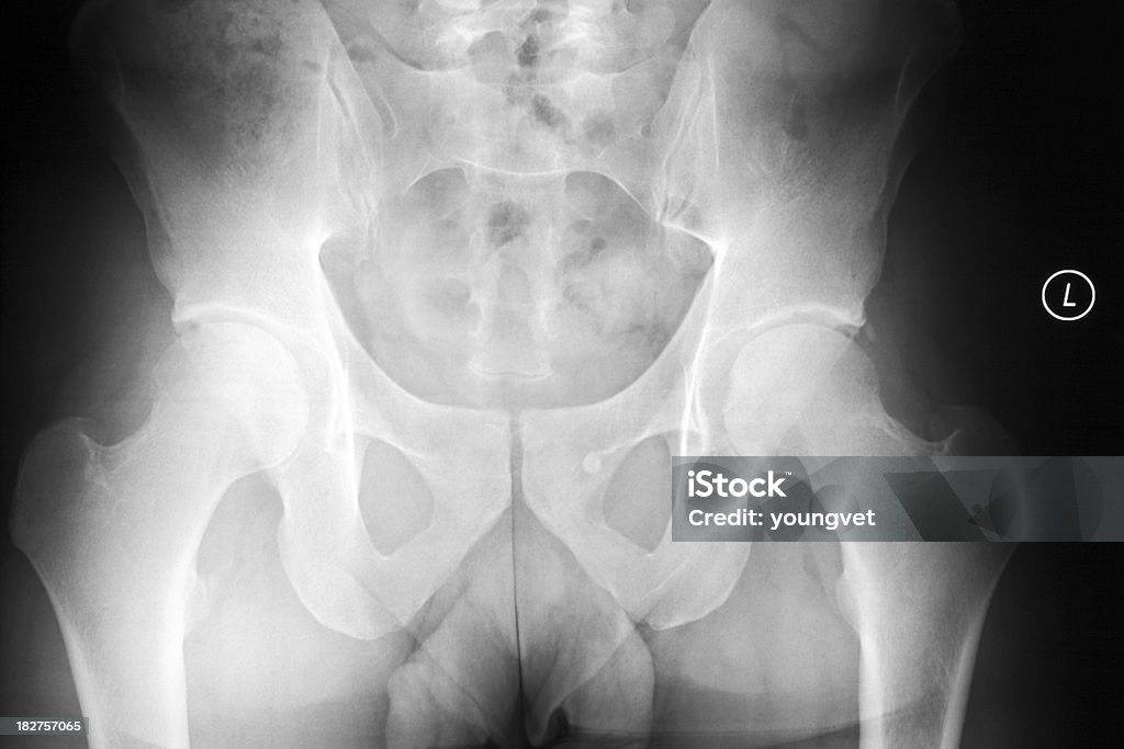 X -ray of a 雄骨盤および大腿骨 - 30代のロイヤリティフリーストックフォト