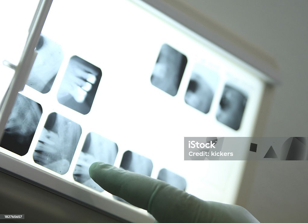 Baixa foto chave do dedo apontando no raio-x Odontológico - Foto de stock de Apontar - Sinal Manual royalty-free