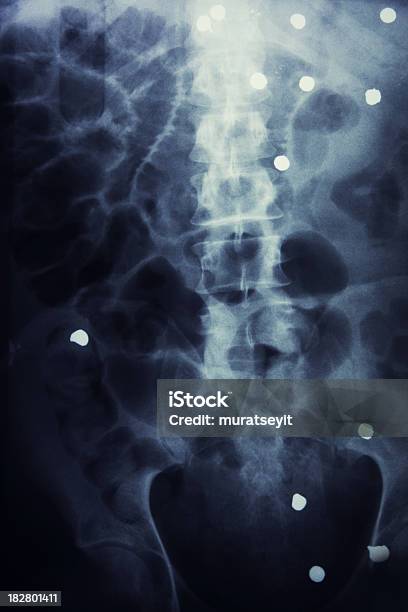 Fotografía De Un Tiro Desde El Abdomen Foto de stock y más banco de imágenes de Imagen de rayos X - Imagen de rayos X, Disparar, Bala - Munición