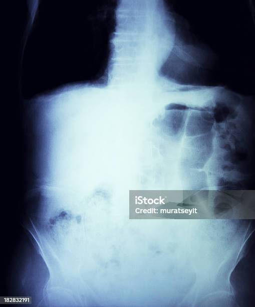 Bauch Und Lunge Xray Stockfoto und mehr Bilder von Anatomie - Anatomie, Bauch, Brustbereich