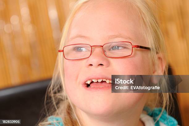 Girl With Down Syndrome Laughing Stock Photo - Download Image Now - 6-7 Years, Child, Children Only
