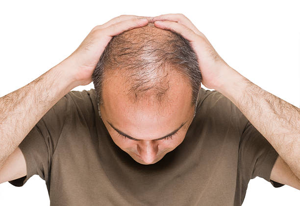 homme endeuillées bereaved - balding photos et images de collection