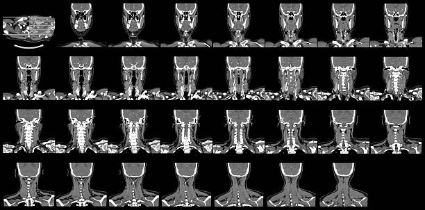 首の ct - angio ストックフォトと画像