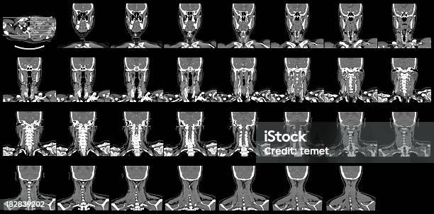 Neck Ct Stock Photo - Download Image Now - CAT Scan, CAT Scan Machine, Cervical Vertebrae