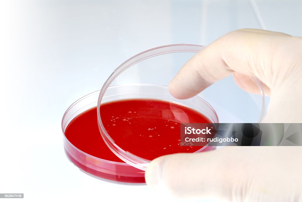 Ágar Sangue prato com as bactérias - Foto de stock de Bactéria royalty-free