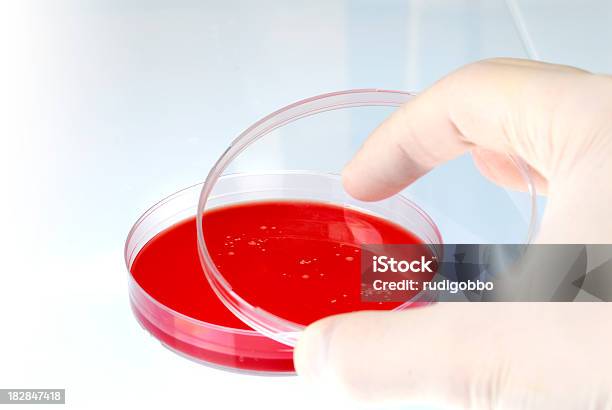 Foto de Ágar Sangue Prato Com As Bactérias e mais fotos de stock de Bactéria - Bactéria, Biologia, Colônia - Grupo de Animais