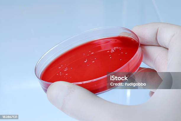 Agar Sangue Placa Com Bactérias - Fotografias de stock e mais imagens de Agar Sangue - Agar Sangue, Bactéria, Biologia