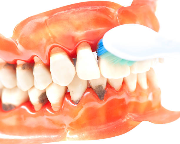 набор зубы с caries макро фото и зубная щётка - dentures human teeth stack laboratory стоковые фото и изображения