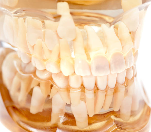 세트마다 투명 이-transparentes gebiss - dentures human teeth stack laboratory 뉴스 사진 이미지