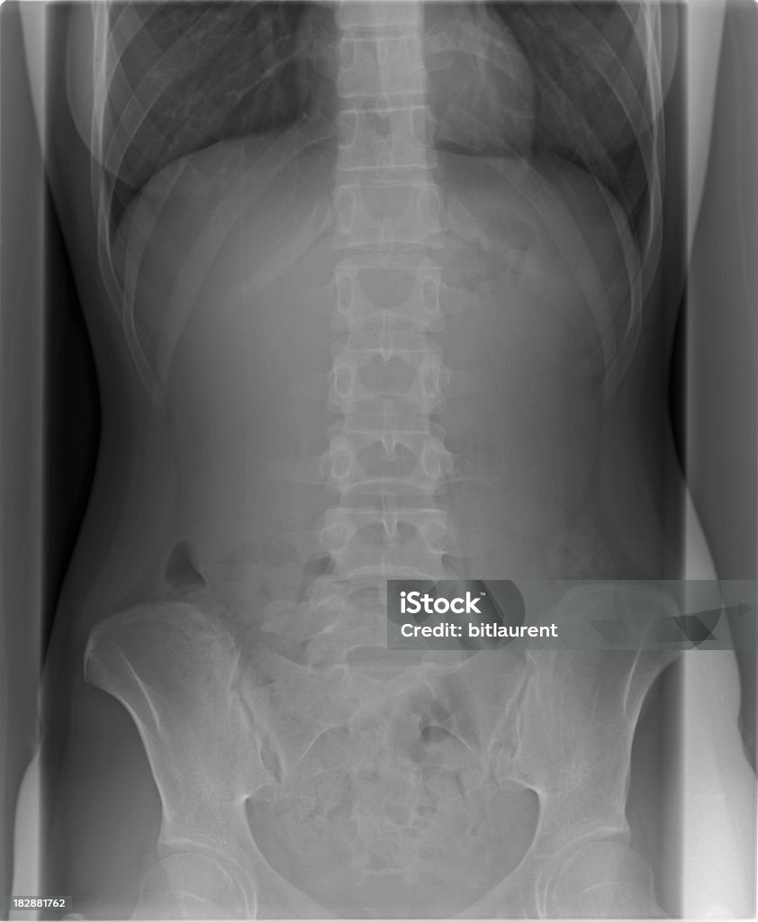 radiografia corrercontra e bacino - Foto de stock de Anatomia royalty-free