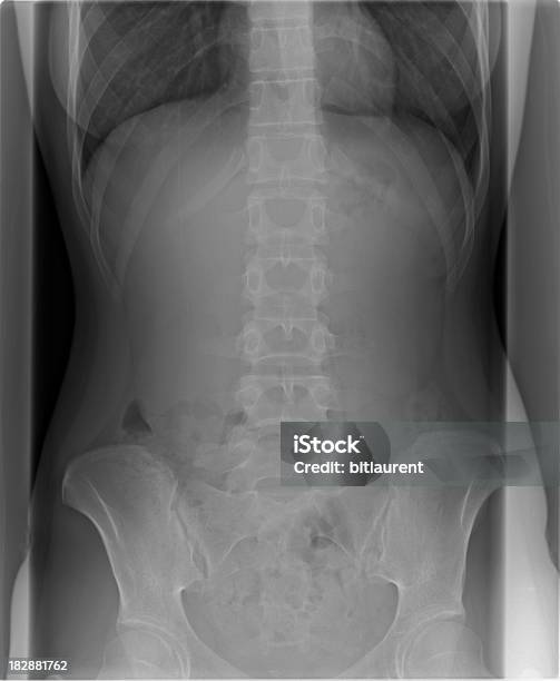 Foto de Radiografia Corrercontra E Bacino e mais fotos de stock de Anatomia - Anatomia, Articulação Humana - Termo anatômico, Articulação humana