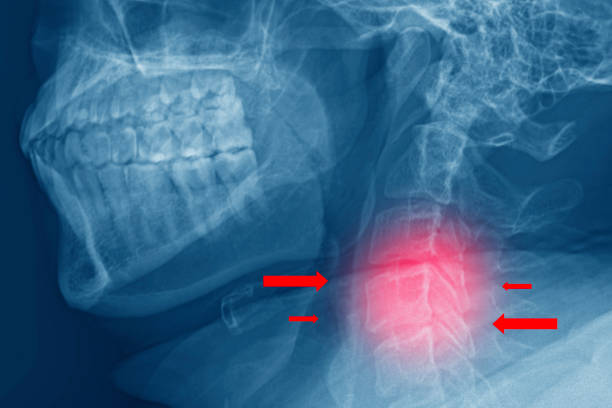 Human neck X-ray Film