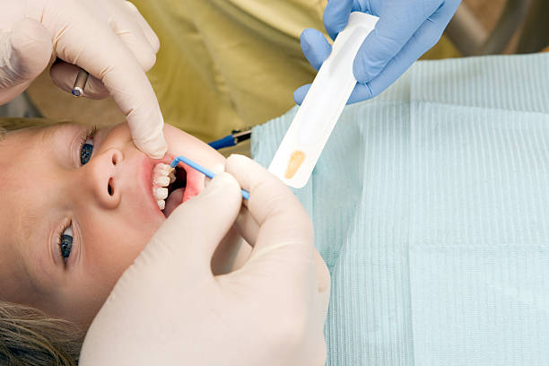 Niño chico que reciben tratamiento de fluoruro de dentista - foto de stock